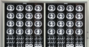 Негатоскоп: преимущества и особенности